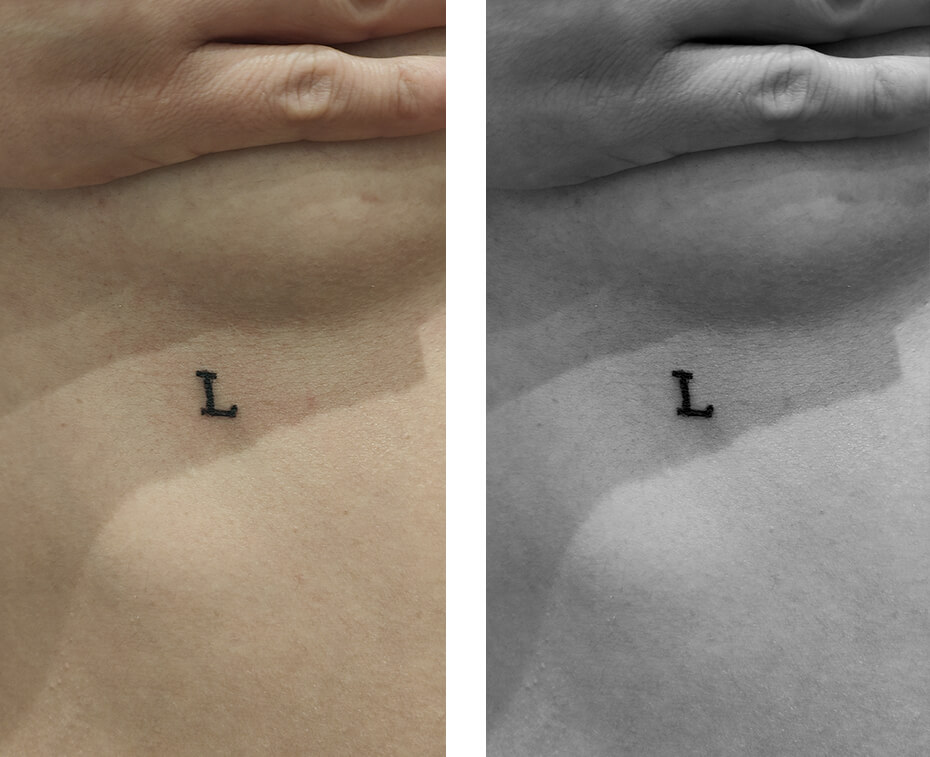 L