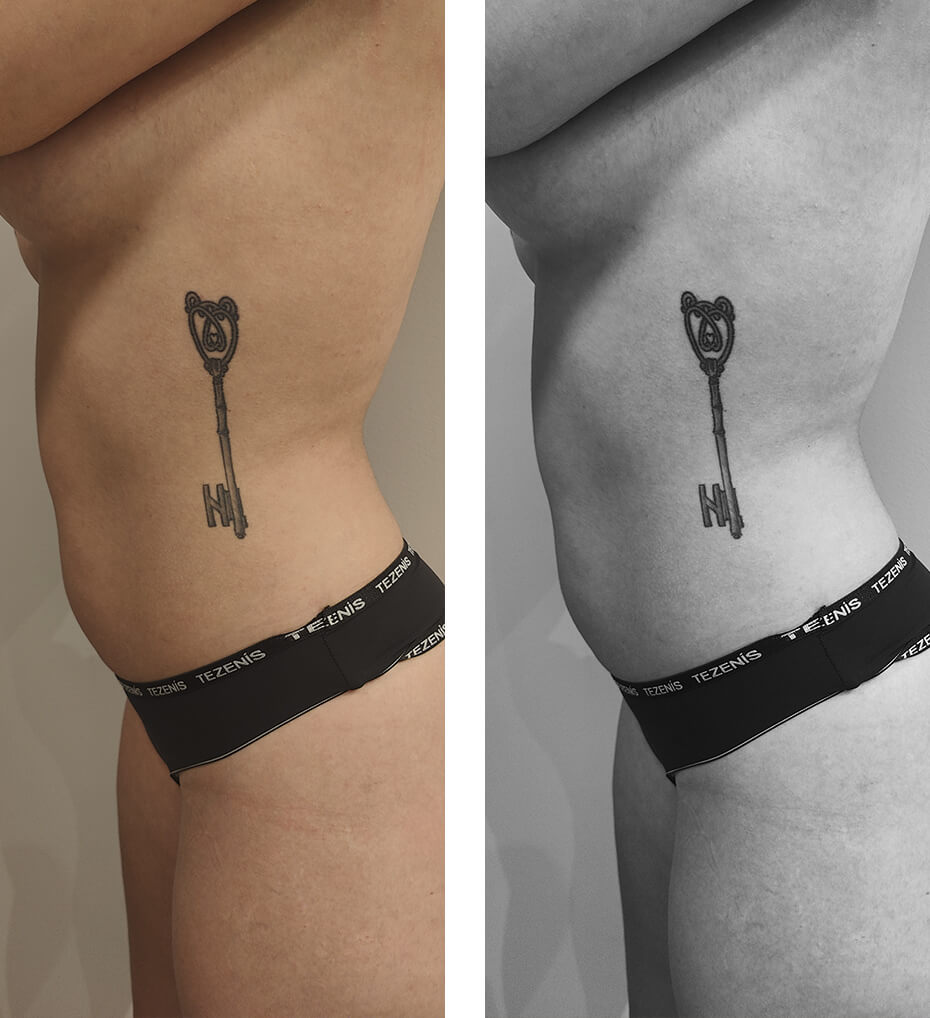 Llave