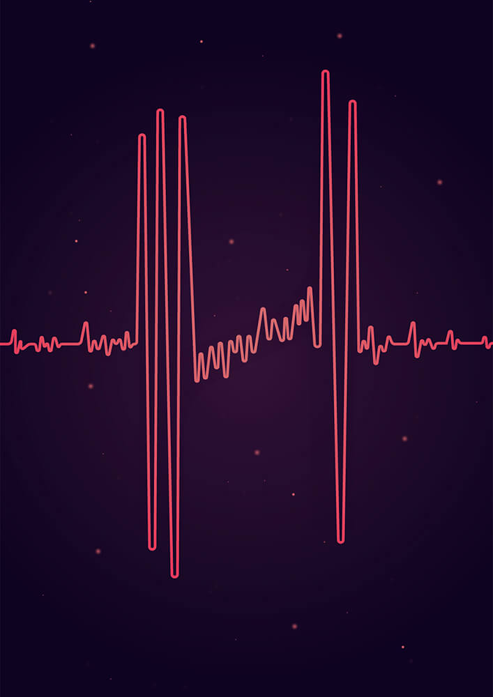 Cardio